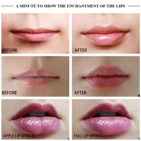 Lip Plumper Lip Enhancer Electric Silicone Lip Enhancer Tool Lip Artifact New - Picture 8 of 14